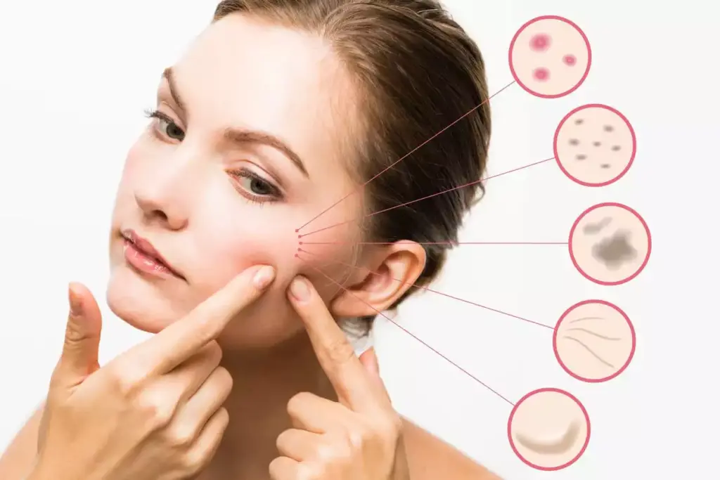 Skincare Solutions: Achieve Radiant Skin with Compounded Skincare